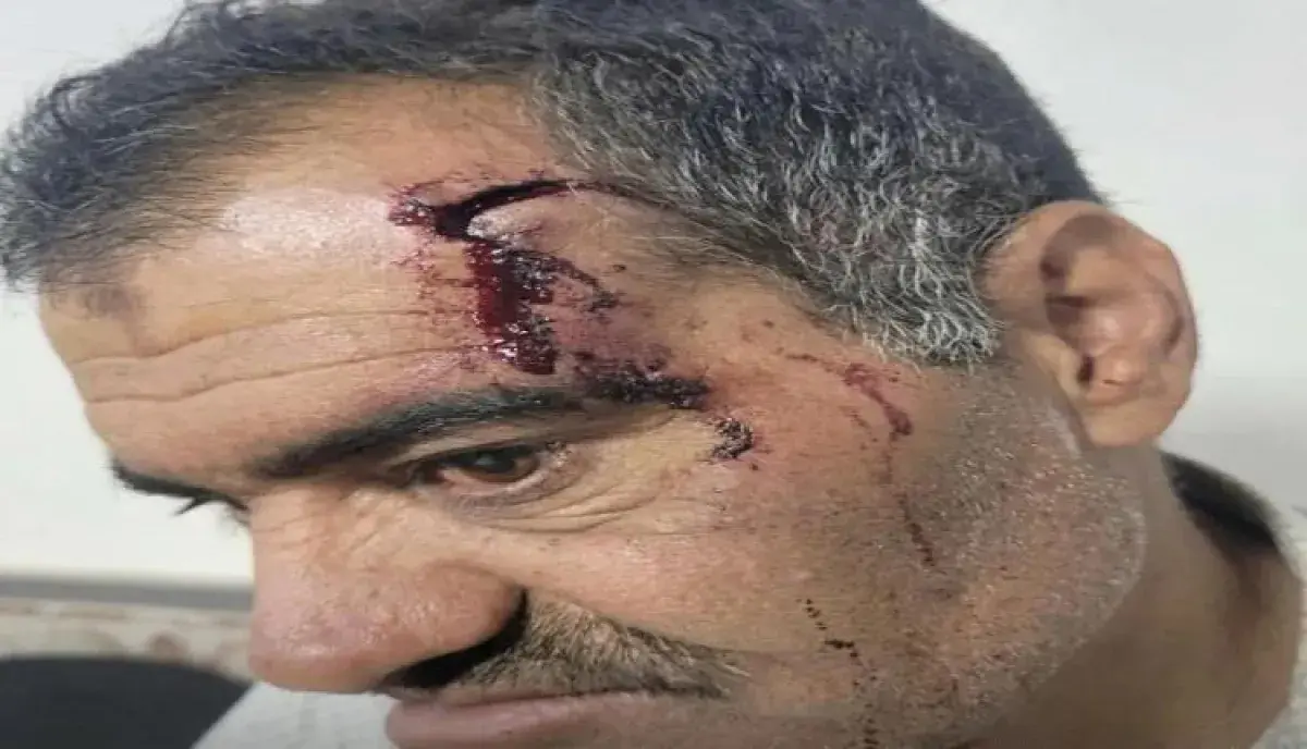 همجية الجبايات في ذمار.. عناصر "الزكاة" الحوثية تسحل عاقل حارة وتنكّل به علناً لإرهاب المجتمع