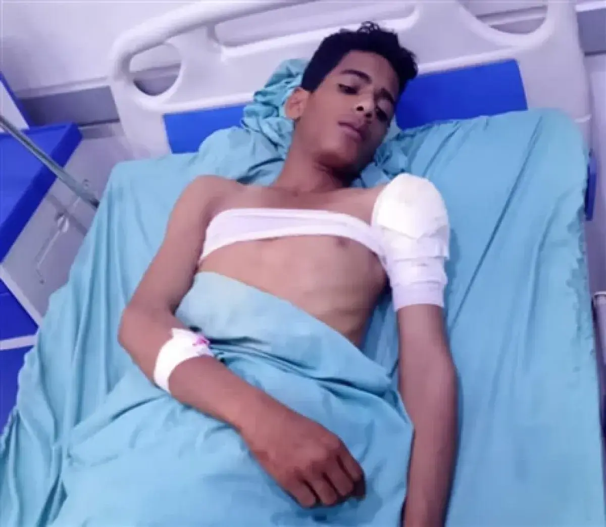 قذائف الحوثيين تحصد المدنيين في لحج.. إصابة فتى ون...