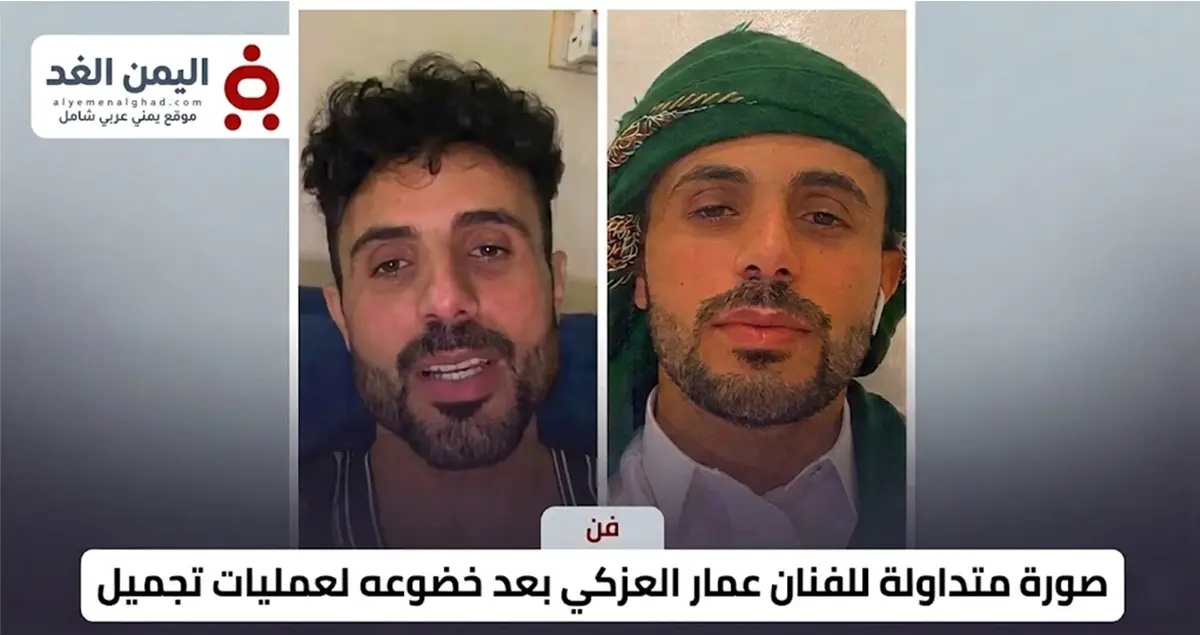 صدمة وتفاعل واسع.. ملامح جديدة للفنان عمار العزكي...