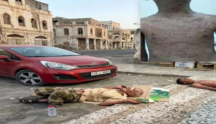 ثورة الفرشان.. أهالي الخساف يعلنون اعتصاماً مفتوحاً في شارع أروى احتجاجاً على انهيار الكهرباء في عدن