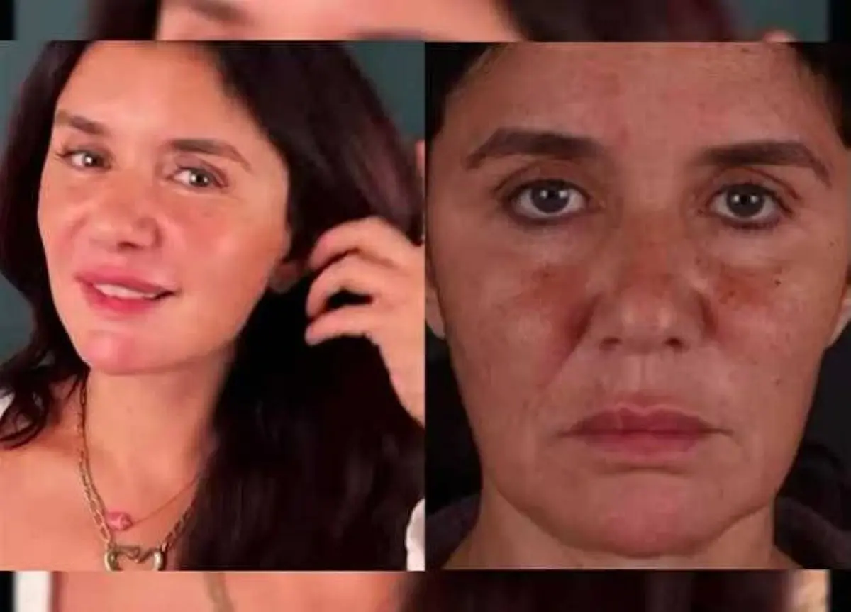 بعد اعتراف غادة عادل..نجمات كشفن تشوهات غير متوقعة وخطرة لعمليات التجميل