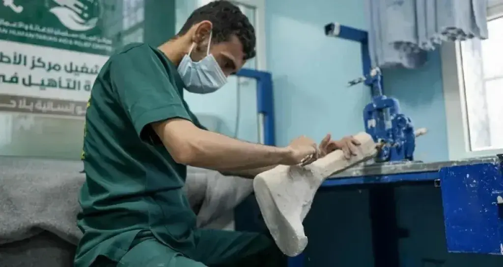 الأطراف الصناعية بمأرب يقدّم أكثر من 1500 خدمة طبي...