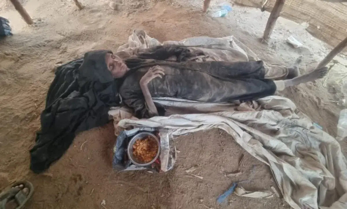 وفاة مُسنة نازحة جراء الجوع والمرض داخل مخيم نزوح في عبس بحجة