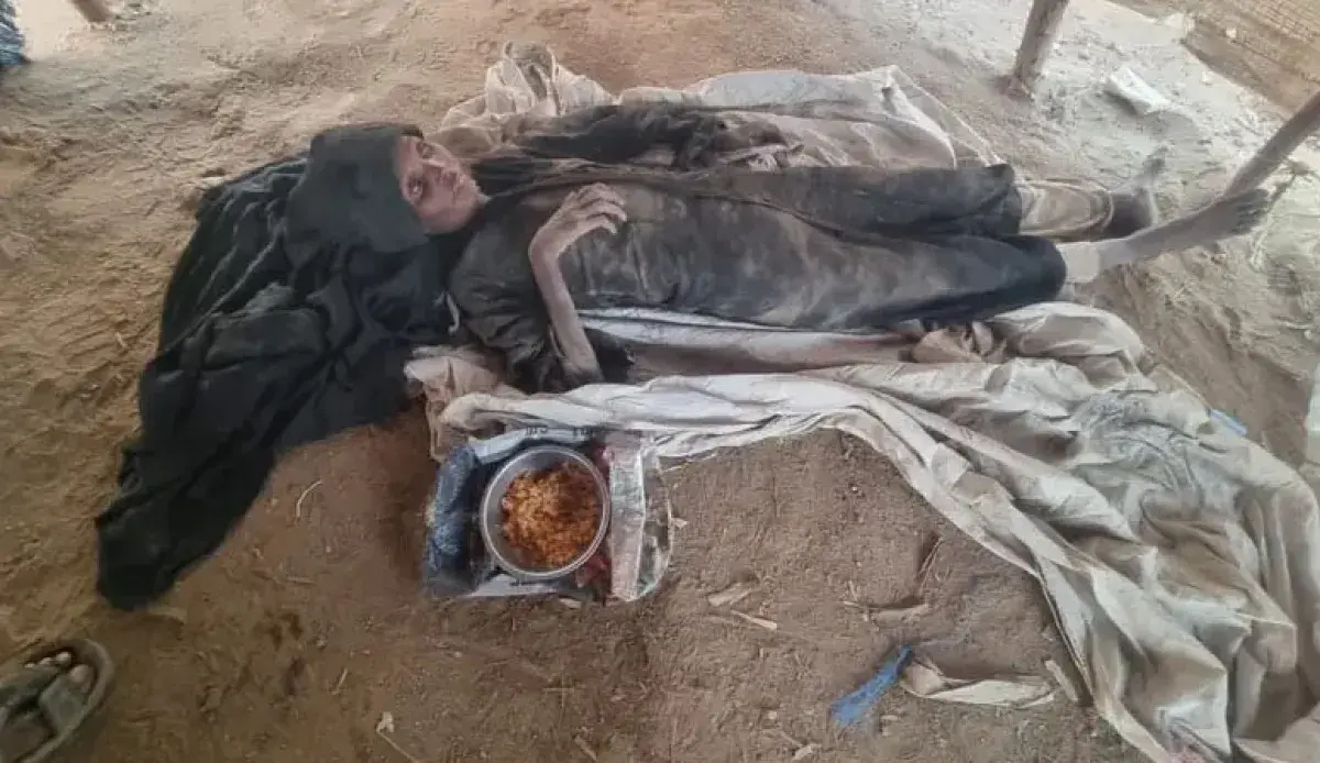 مأساة في حجة.. الجوع يطوي حياة زوجين نازحين داخل م...