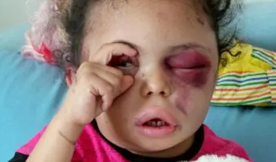 بعد 4100 يوم.. ماذا فعل العدوان باليمن؟