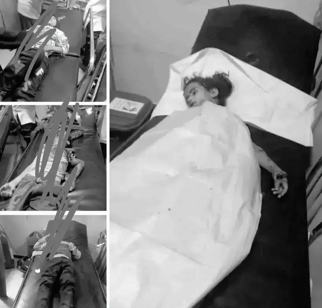 فاجعة إنسانية.. سقوط 8 أطفال بين شهيد وجريح بانفجار من مخلفات الحوثيين بالضالع