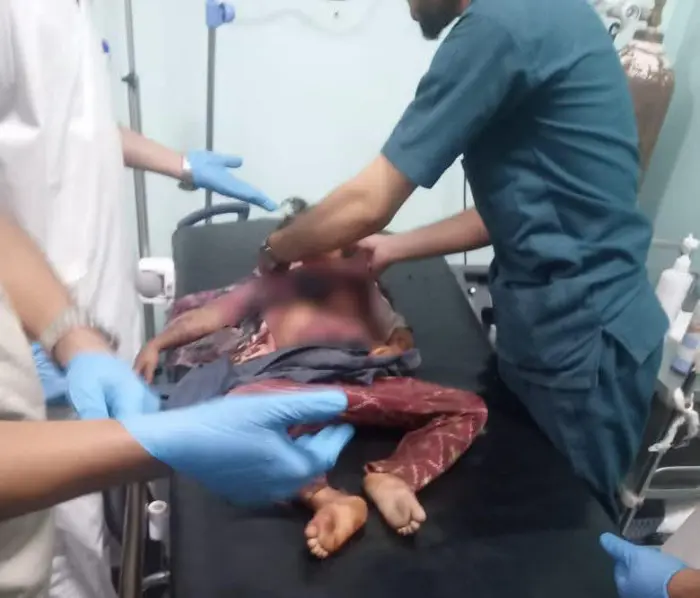 استشهاد 4 أطفال وإصابة 8 آخرين في انفجار بالضالع