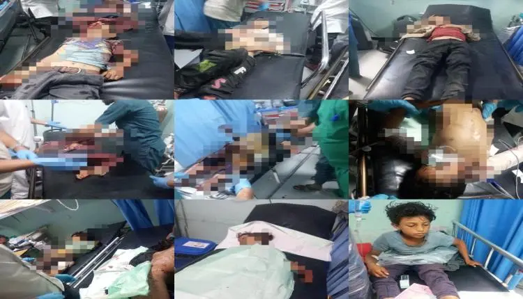 محافظ الضالع يوجه باستنفار طبي شامل لإنقاذ ضحايا ا...