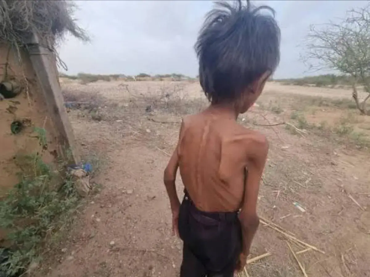 الغليان تحت الرماد.. هل تقود سياسة الإفقار الحوثية...