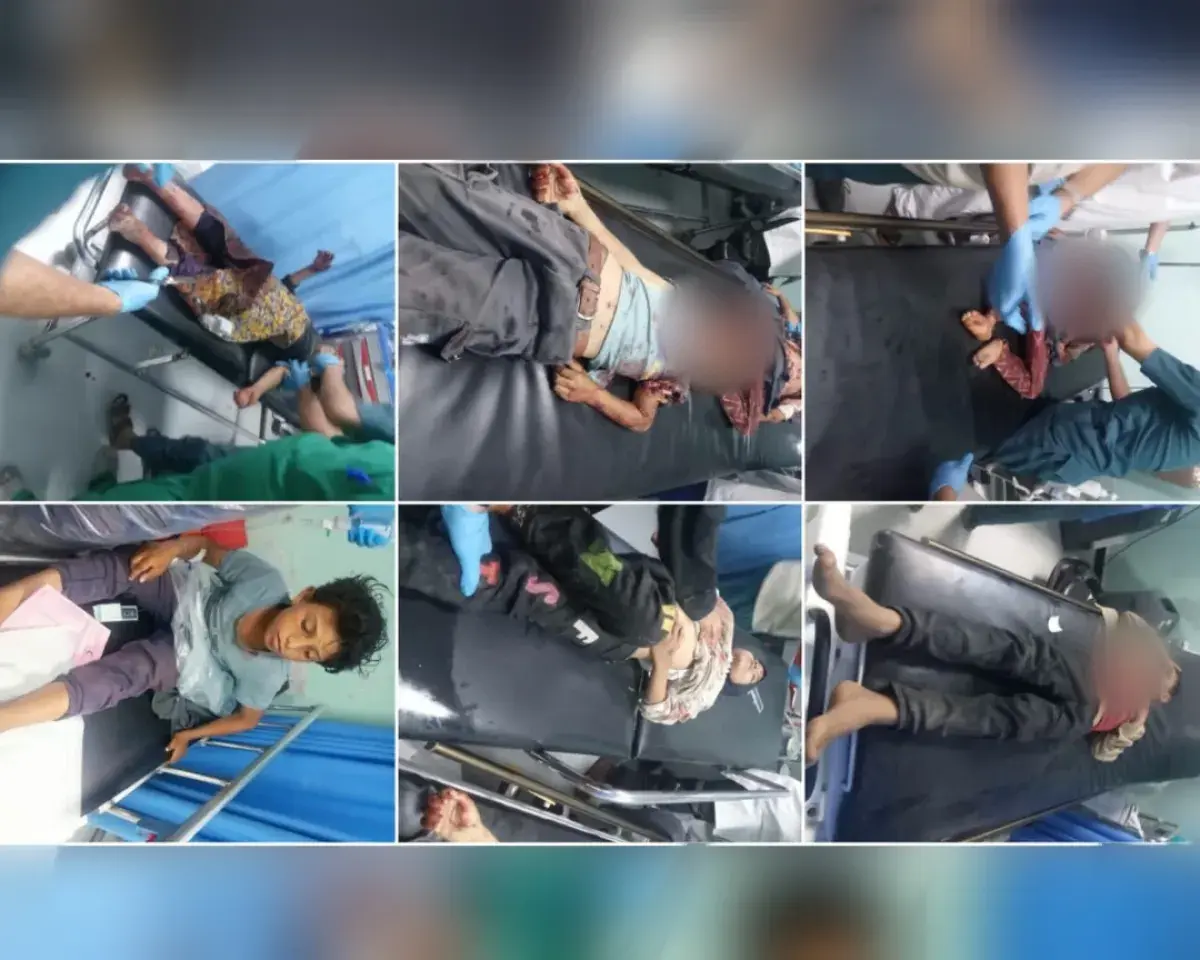 أدانت مجزرة الأطفال بالضالع.. حقوق الإنسان: استمرار مليشيا الحوثي في زراعة الألغام يحصد مزيداً من الأرواح