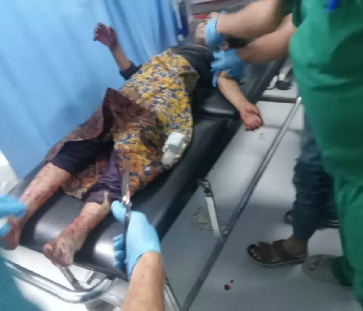 ارتفاع ضحايا انفجار مخلفات حوثية في الضالع إلى 5 أطفال شهداء