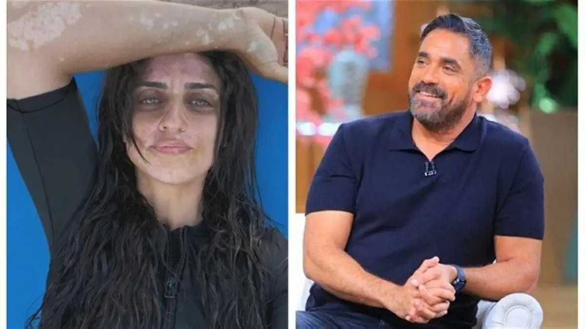 «هو انتي فيه في حلاوتك».. رسالة من أمير كرارة لشقيقته بعد كشف معاناتها مع مرض جلدي