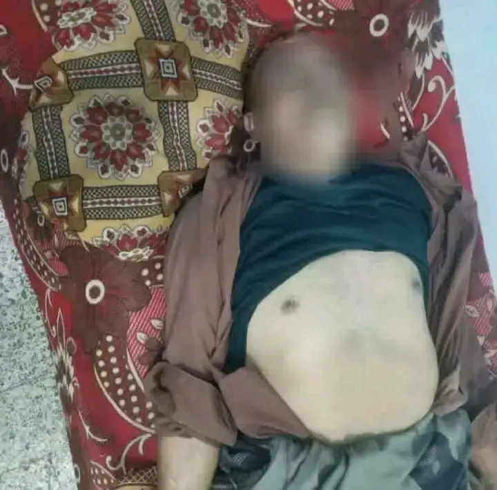 ذمار.. وفاة مواطن بصاعقة رعدية ضربت منزله في وصاب...