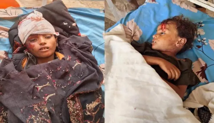 مقتل طفلين دهسا في المخا أثناء توزيع مساعدات غذائي...