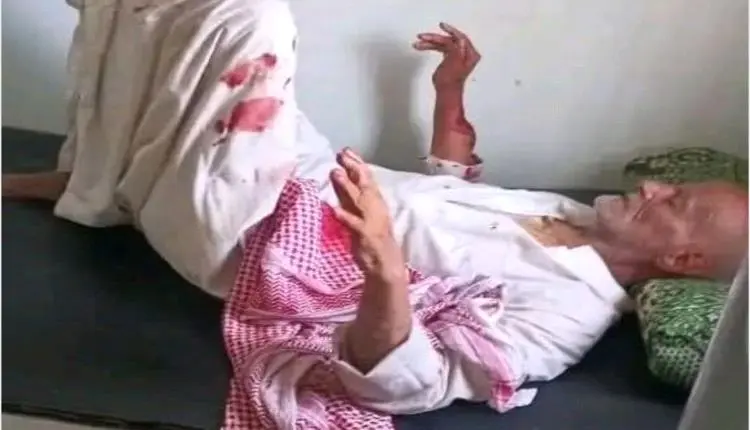 إعتداء دموي على مسن.. يُبتر إصبعه ويُطعن بوحشية في...