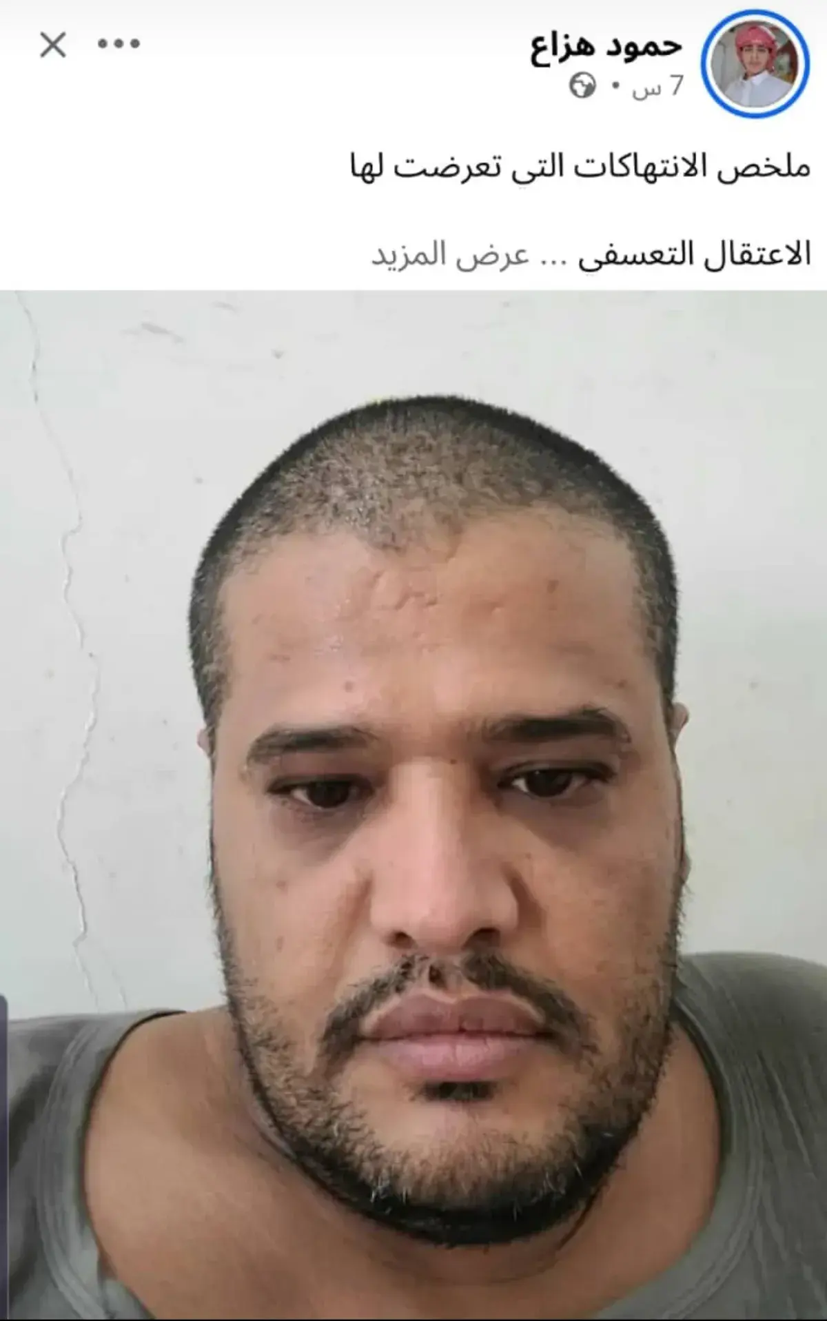 صحفي يكشف عن انتهاكات قال إنه تعرض لها في سجون حزب الإصلاح بمأرب