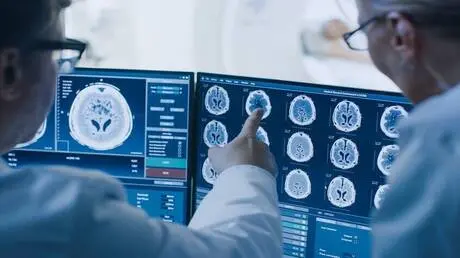 دراسة تكشف علاقة بين الغلوكوز وتسارع شيخوخة الدماغ