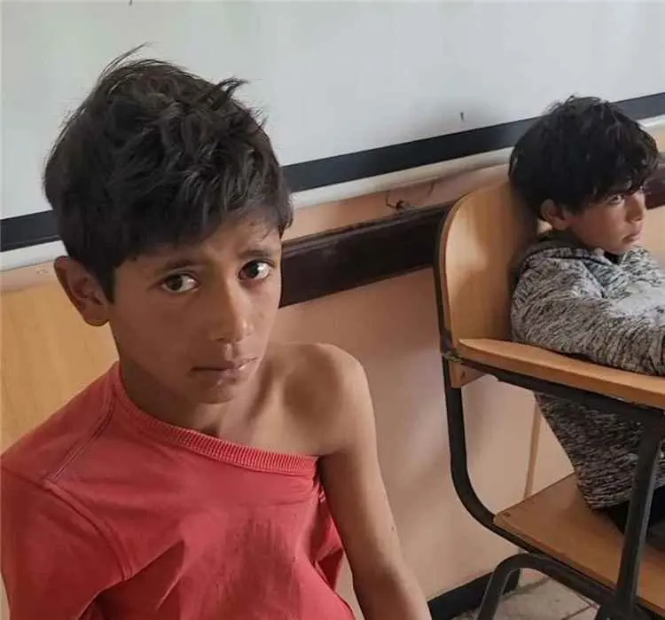 تعز .. تسجيل أربع إصابات جديدة بعضات كلاب بعد وفاة...