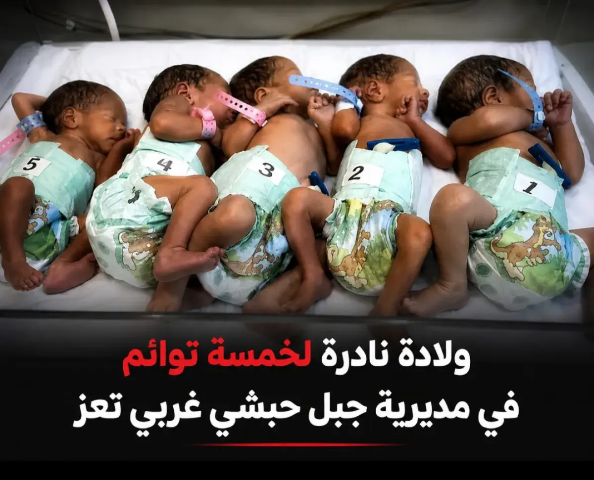 ولادة نادرة لخمسة توائم في مديرية جبل حبشي غربي تعز