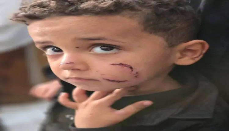 كلاب مسعورة تحاصر طفل في تعز وإعلامي ينقذه نقاذه ف...