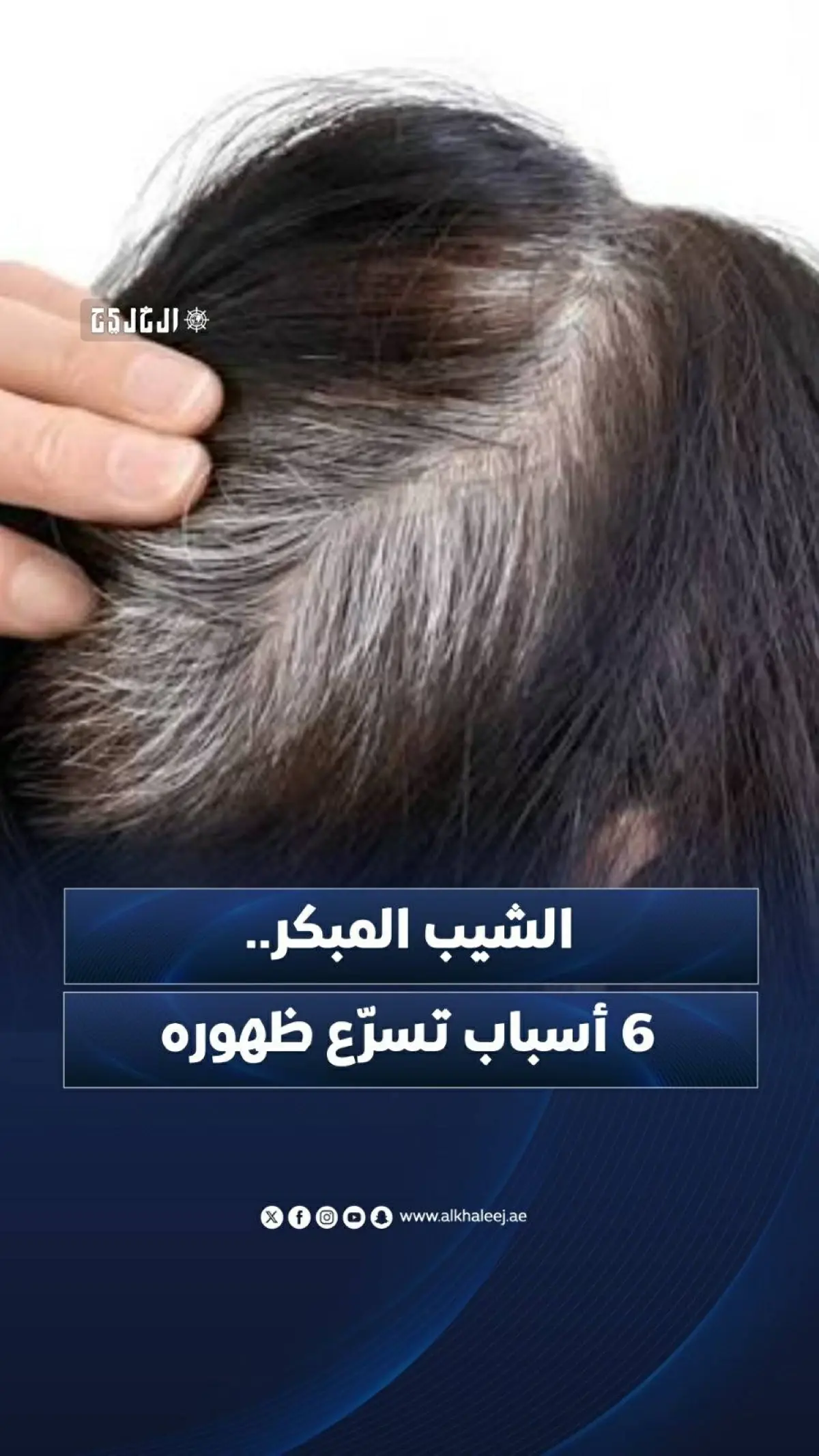 الشيب المبكر.. 6 أسباب تسرّع ظهوره