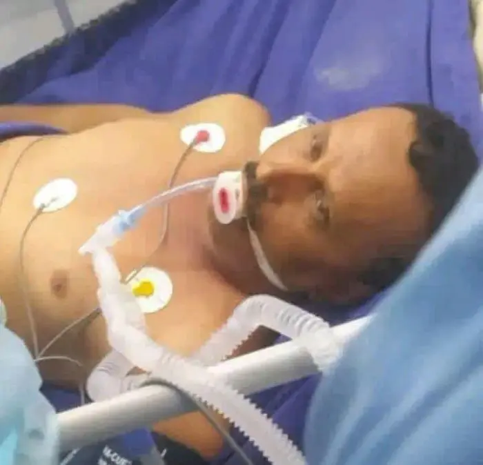 أحد ضحايا القصف السعودي.. استشهاد عبدالرحيم الردفاني بعد غيبوبة لـ8 أشهر