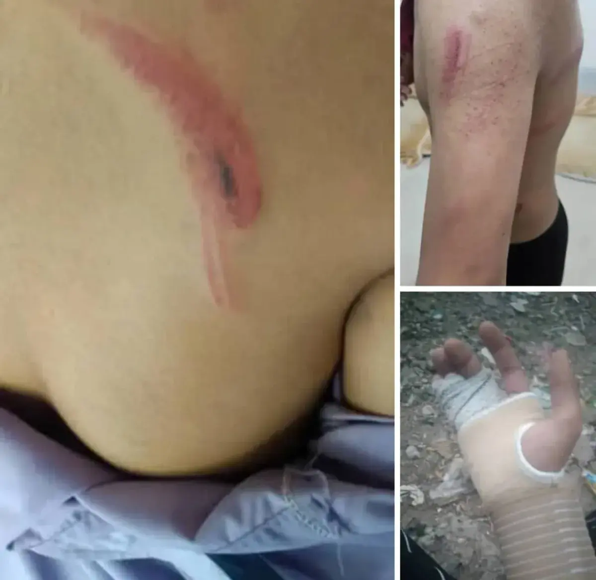 تعز.. مدير مدرسة أهلية حوثي يعتدي بصاعق كهربائي عل...