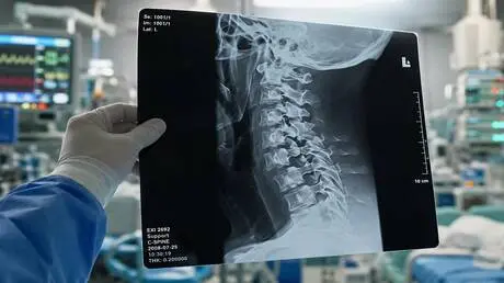 بعد سقوطها من الطابق الثالث.. جراحو الأعصاب الروس...