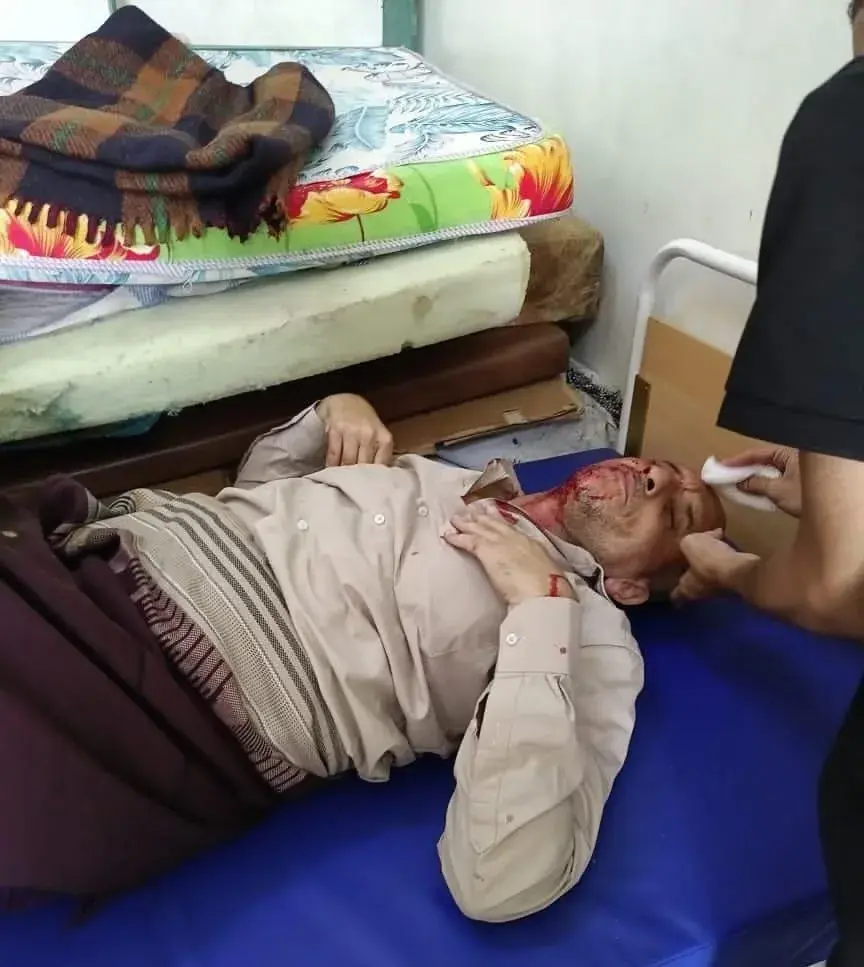مليشيات الحوثي تقصف مدنيين على خط مريس–دمت وتصيب أكثر من ثلاثة أشخاص