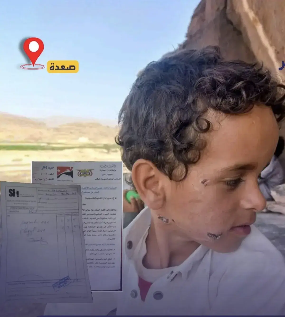 اسرار | بالصور والتفاصيل- لقاحات مغشوشة أم سوء تخز...