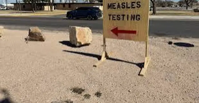 وفاة شخصين بمرض الحصبة في ولاية بنسلفانيا