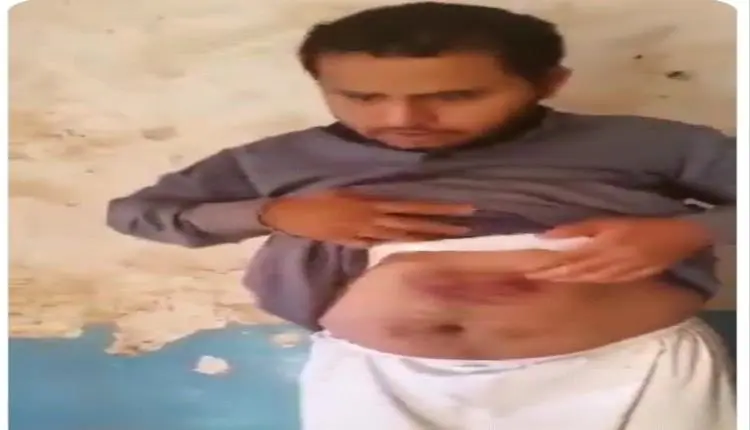 تعذيب ونهب داخل صعدة.. قيادات حوثية تزج بمواطن في...