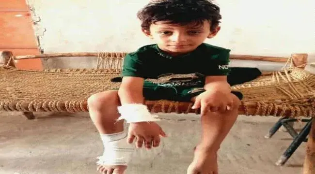 إصابة طفل بقصف حوثي استهدف منزلًا جنوب الحديدة