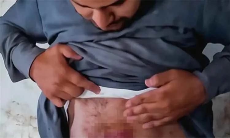 صعدة.. الحوثيون يحتجزون مواطنًا ويعذبونه ويصادرون ممتلكاته