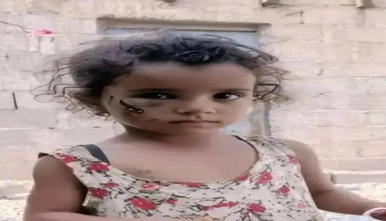 وفاة الطفلة خديجة بعد أيام من تعرضها لعضة كلب مسعو...