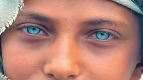 "رسام" اليمني يخطف أضواء  الحرب بعينيه ويتحول لظاه...