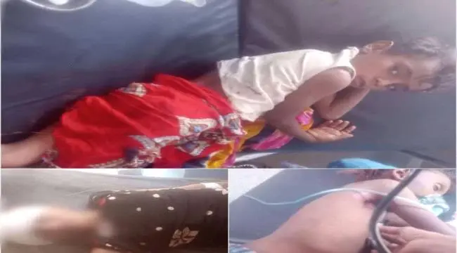 "بعد هزيمتها في الجبهات.. قذائف الحوثي تحصد أرواح...