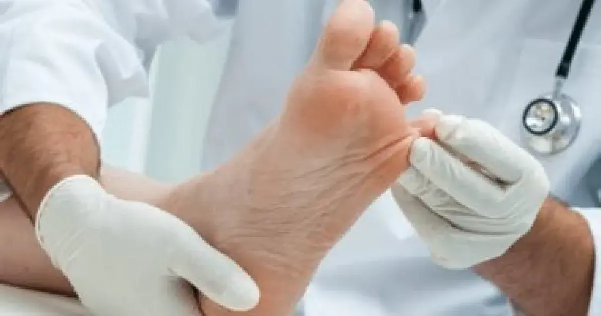 فطريات الأظافر: أسبابها، صعوبة علاجها، وطرق التعام...