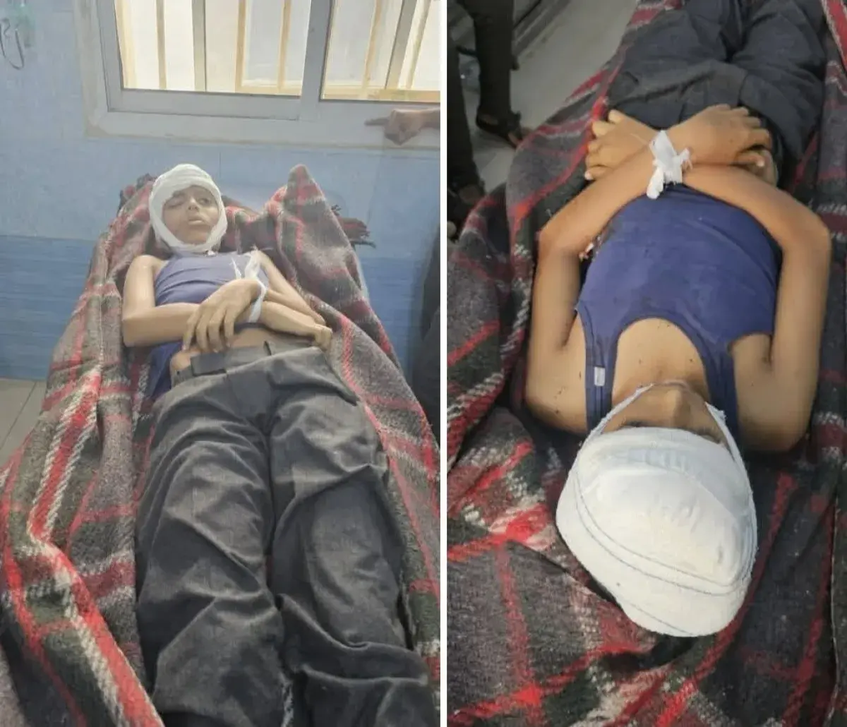 مليشيا الحوثي تقصف منزلًا سكنيًا في تعز.. مقتل طفل...