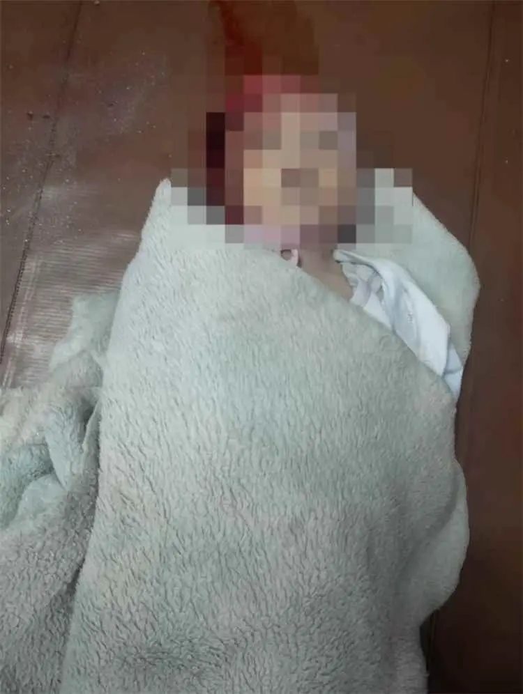 رضيع في يومه الـ14 ضحية قصف حوثي على تعز وإصابة 14 مدنيًا