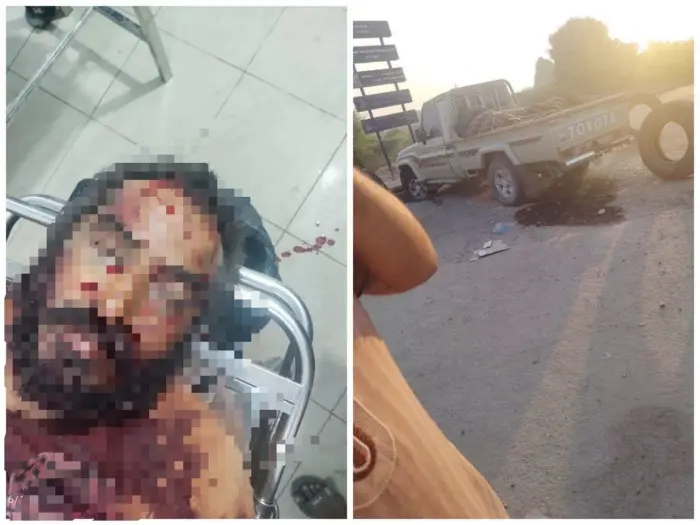 مصرع قيادي بتنظيم القاعدة الإرهابي خلال اشتباكات ف...