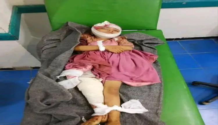 عملية بلا تخدير حتى فارقت الحياة.. مأساة الطفلة "م...