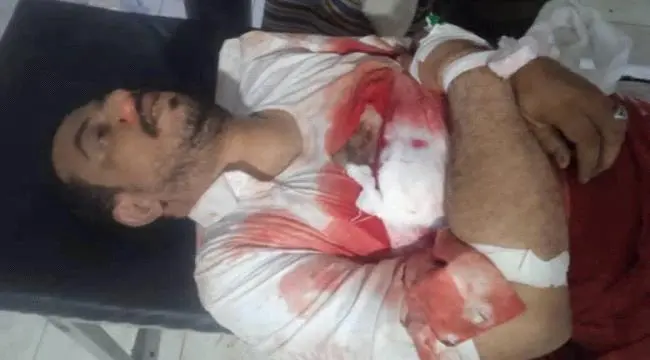 مشايخ #أحور يدينون مقتل الكثيري على الخط الساحلي و...