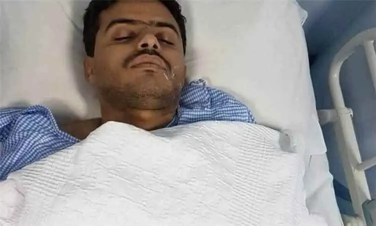 «رحلة نقل المسافرين انتهت بركام ولغم».. وفاة سائق متأثراً بإصابته في مصائد الموت الحوثية بالجوف