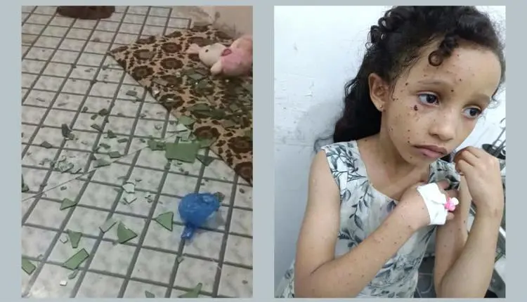 إصابة الطفلة نوف أثناء لعبها داخل منزلها بقذيفة حو...